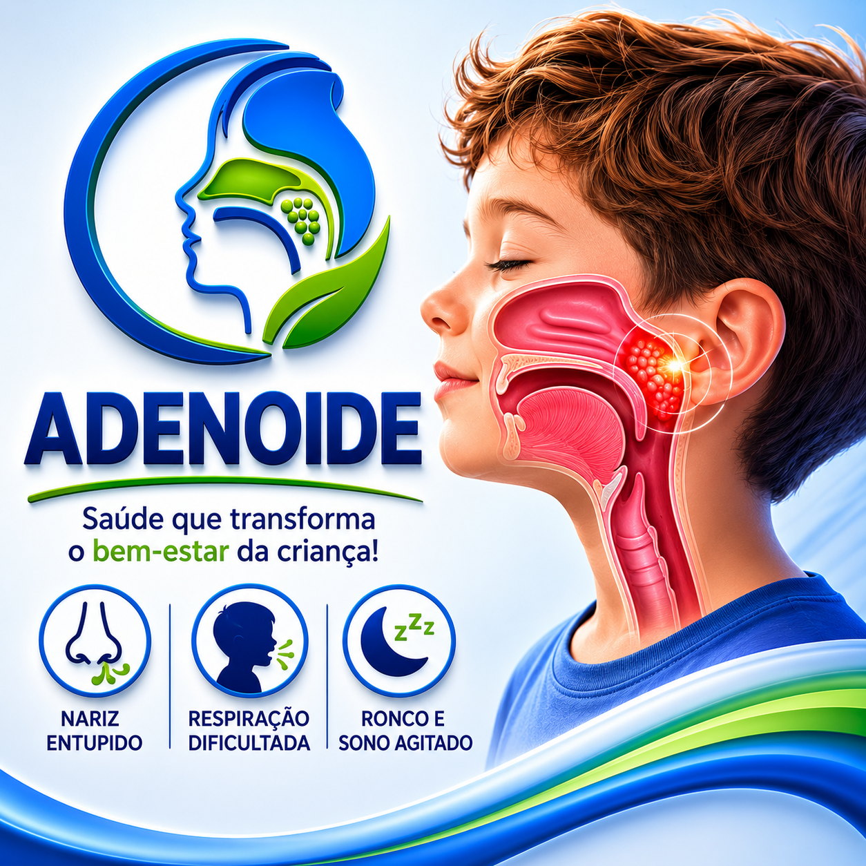 Adenoide